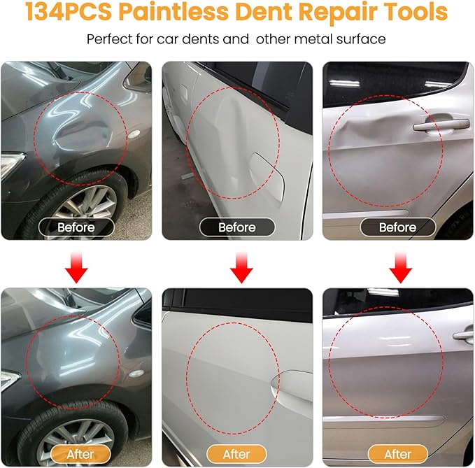 134PCS Dent Puller, Paintless Dent Removal Kit – All-in-One Car Dent Puller Kit