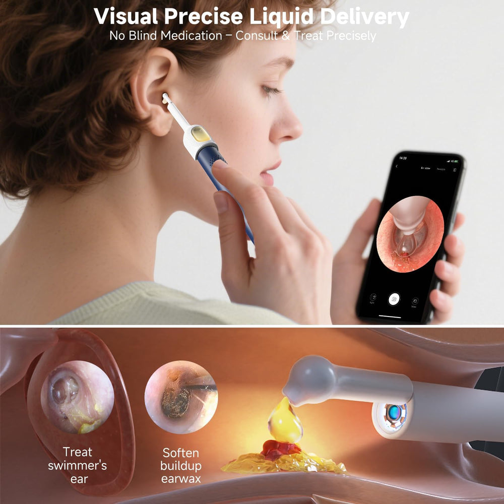 BEBIRD R1 Ultra Ear Wax Removal: 1296P HD Ear Camera Cleaner Tweezers IP67