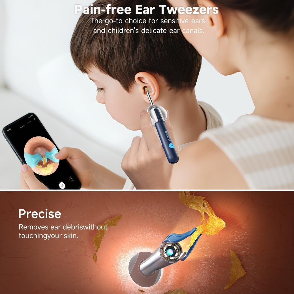BEBIRD R1 Ultra Ear Wax Removal: 1296P HD Ear Camera Cleaner Tweezers IP67