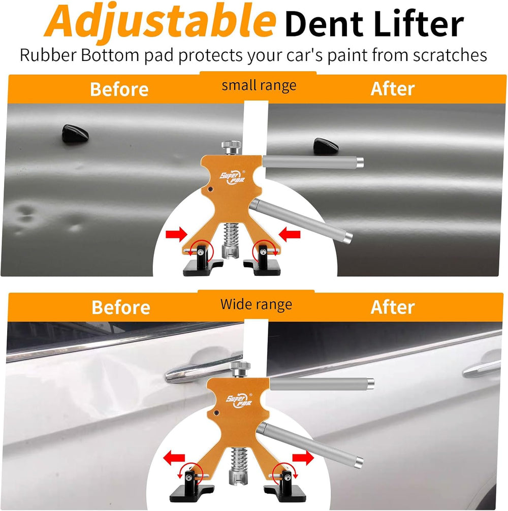 Super PDR Paintless Dent Repair Kit 148PCS Dent Puller Kit with LED Light Boa...